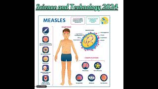 MEASLES Science and Technology 2024 Banking Competative exams Current Affairs [upl. by Shadow625]