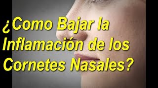 5 👀TRATAMIENTOS NATURALES para los 👃CORNETES de la NARIZ  Al 👉FINAL QUEDARAS 😲SORPRENDIDO [upl. by Llenwahs]