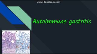 Autoimmune gastritis [upl. by Gnahk683]