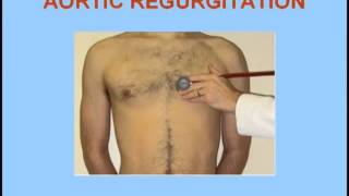 Aortic Stenosis vs Aortic Regurgitation [upl. by Darla560]