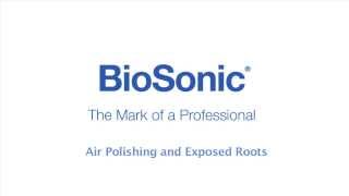 BioSonic Suvi Air Polishing and Exposed Roots [upl. by Yeldar]