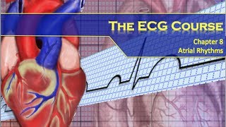 The ECG Course  Atrial Rhythms [upl. by Tolman175]