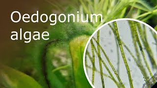 Oedogonium Algae Under a Microscope 100x1000x [upl. by Tower]