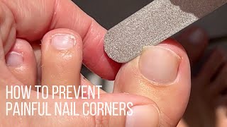 How to prevent painful nails by rounding off nail corners wultra thin diamond file [upl. by Sire667]