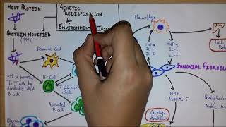 What is rheumatoid arthritis Part 1  Introduction Etiology Pathogenesis [upl. by Verile]