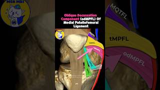 Fig 4A01 Anatomy of the Medial Patellar Retinacular Complex Part 1 [upl. by Sidonie]