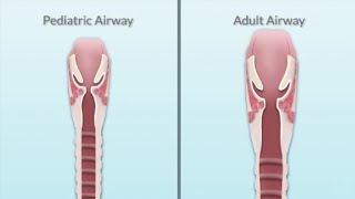 Pediatric Airway Assessment by T Miller  OPENPediatrics [upl. by Naltiac390]