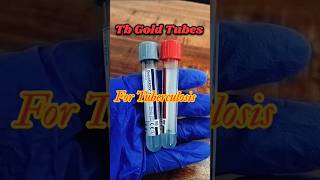 Tb Gold TubesTb Gold sample collection tubesTuberculosis test youtubeshorts shorts tranding [upl. by Inavihs944]