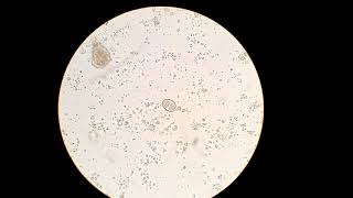 Evoluated oocyst of Isospora under de microscope from a kitten stool [upl. by Ahsekan]