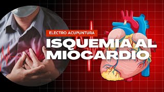 Isquemia al Miocardio Tratado con Electroacupuntura [upl. by Okire]