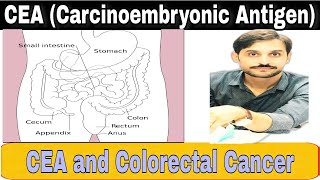 CEA Test  Carcinoembryonic Antigen [upl. by Alister]