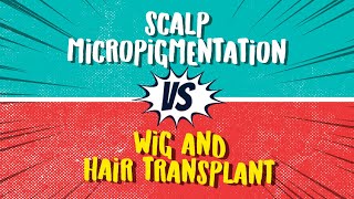 SMP vs Other Hair Loss Solutions [upl. by Fitts]