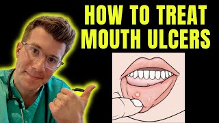 How to recognise and treat Mouth Ulcers getting rid of canker sores  Doctor ODonovan explains [upl. by Bobbe]