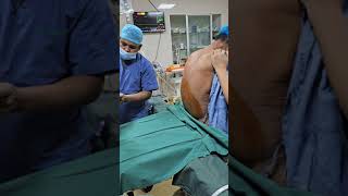 Spinal Anaesthesia for Low Cardiac Reserve patient low EFanesthesia spinal [upl. by Elimaj]