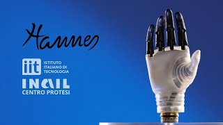 Hannes prosthetic hand [upl. by Antonietta]