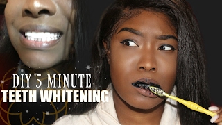 5 MINUTE TEETH WHITENING  DIY CHARCOAL TOOTHPASTE [upl. by Atiken]