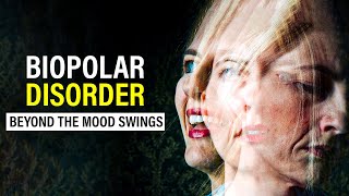 Bipolar Disorder  Mental Health  Healing Mind [upl. by Florry]