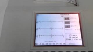 ELECTROCARDIÓGRAFO BURDICK MODELO ECLIPSE 850 [upl. by Ellimak74]