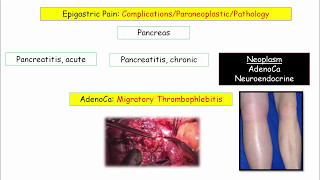 12DaysinMarch Epigastric Pain and Pancreatic Disorders for USMLE Step One [upl. by Clarisse]