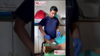 How To Do Dressing of Varicose Ulcer  Dr Ashank Bansal mumbai ulcertreatment [upl. by Khorma]