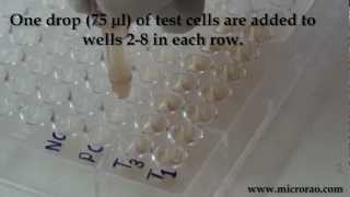 Treponema Pallidum Hemagglutination TPHA test for syphilis [upl. by Augy]