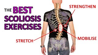 THE Best Exercises For Scoliosis [upl. by Kisor]