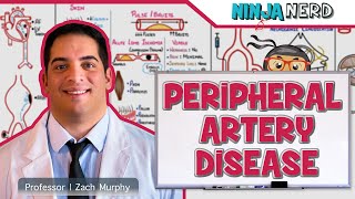 Peripheral Artery Disease  Retired [upl. by Diena]