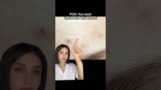 Hydrating Your Skin with Hyaluronic Acid SerumHyaluronicAc [upl. by Ahsinyt]