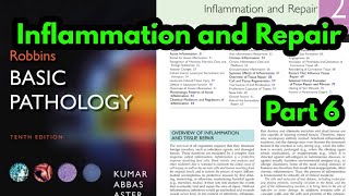 Arachidonic Acid metabolites Robbins pathologyProstaglandins and LeukotrienesInflammatory Mediator [upl. by Allecram88]