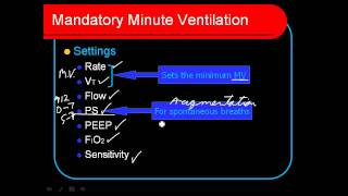 Mandatory Minute Ventilation MMV [upl. by Hubsher]