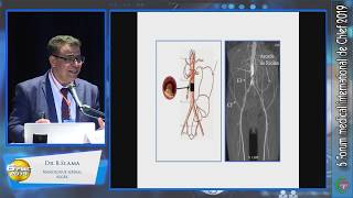 Dr B SLAMA Angiologue libéral ALGER [upl. by Jehius]