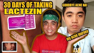 30 DAYS OF TAKING LACTEZIN HONEST REVIEW  SOLUSYON SA PIMPLES ACNE amp SEVERE ACNE [upl. by Wane144]