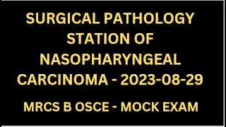 SURGICAL PATHOLOGY STATION OF NASOPHARYNGEAL CARCINOMA [upl. by Mame133]