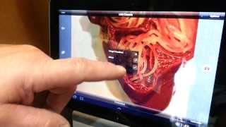 Demonstration Swift Optical Moticam X Wifi Microscope Camera [upl. by Roman]