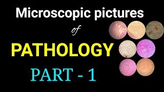 Microscopic pictures of pathology I Dr Poojireddy [upl. by Ahsa]