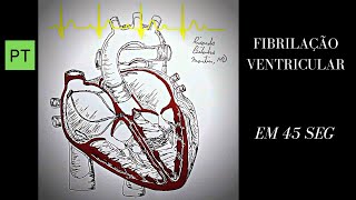 Arritmias Animação cardíaca e ECG  Fibrilação Ventricular Shorts [upl. by Worthington]