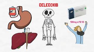 CELECOXIB  CELEBREX  PARA QUÉ SIRVE [upl. by Lramaj168]