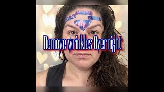 Get Rid Of Forehead Wrinkles Overnight Naturally [upl. by Mihar]