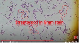 Streptococcus agalactiae [upl. by Arihaj]