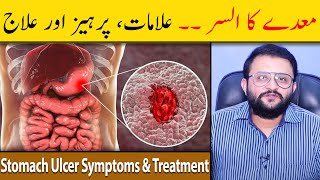 Stomach Ulcer Symptoms amp Treatment  Stomach Ulcer Ka Ilaj  Maidey Ka Ulcer  Dr Raja Omer Fiaz [upl. by Croydon879]