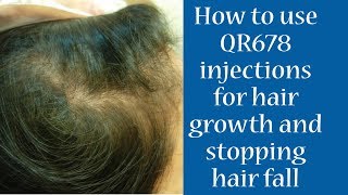 How To Use QR 678 Injection for Hair Growth amp Stopping Hair Fall  Dr Debraj Shome [upl. by Yanehs]