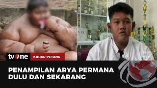 Masih Ingat Arya Bocah Obesitas Begini Sekarang Kondisinya  Kabar Petang tvOne [upl. by Annodal889]