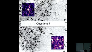 Midbrain Microglia Unique Cell Phenotypes and their Impact on Neuronal Function [upl. by Nevaeh]