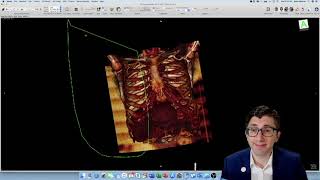 HowTo Creating a 3D Reconstruction of Your Patients CT Scan [upl. by Mandler862]