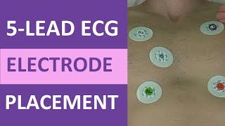 5 Lead ECG Placement of Electrodes EKG NCLEX amp Nursing Mnemonic [upl. by Jdavie]