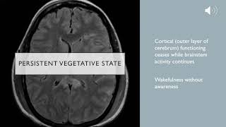 Clinical Death Whole Brain Death and Persistent Vegetative State [upl. by Duer]