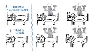 Wean the patient off the ventilator with SmartCarePS  the automated weaning protocol [upl. by Pan]