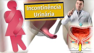 TUDO sobre Incontinência Urinária Perda de Urina [upl. by Edson386]