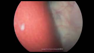 Bacho ki bioscopy 100Real [upl. by Yentuoc]