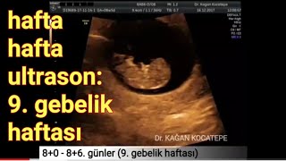 9 gebelik haftasında anne karnındaki bebek  açıklamalı ultrason görüntüleri [upl. by Lowson]